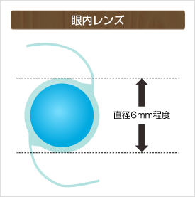 超音波乳化吸引術